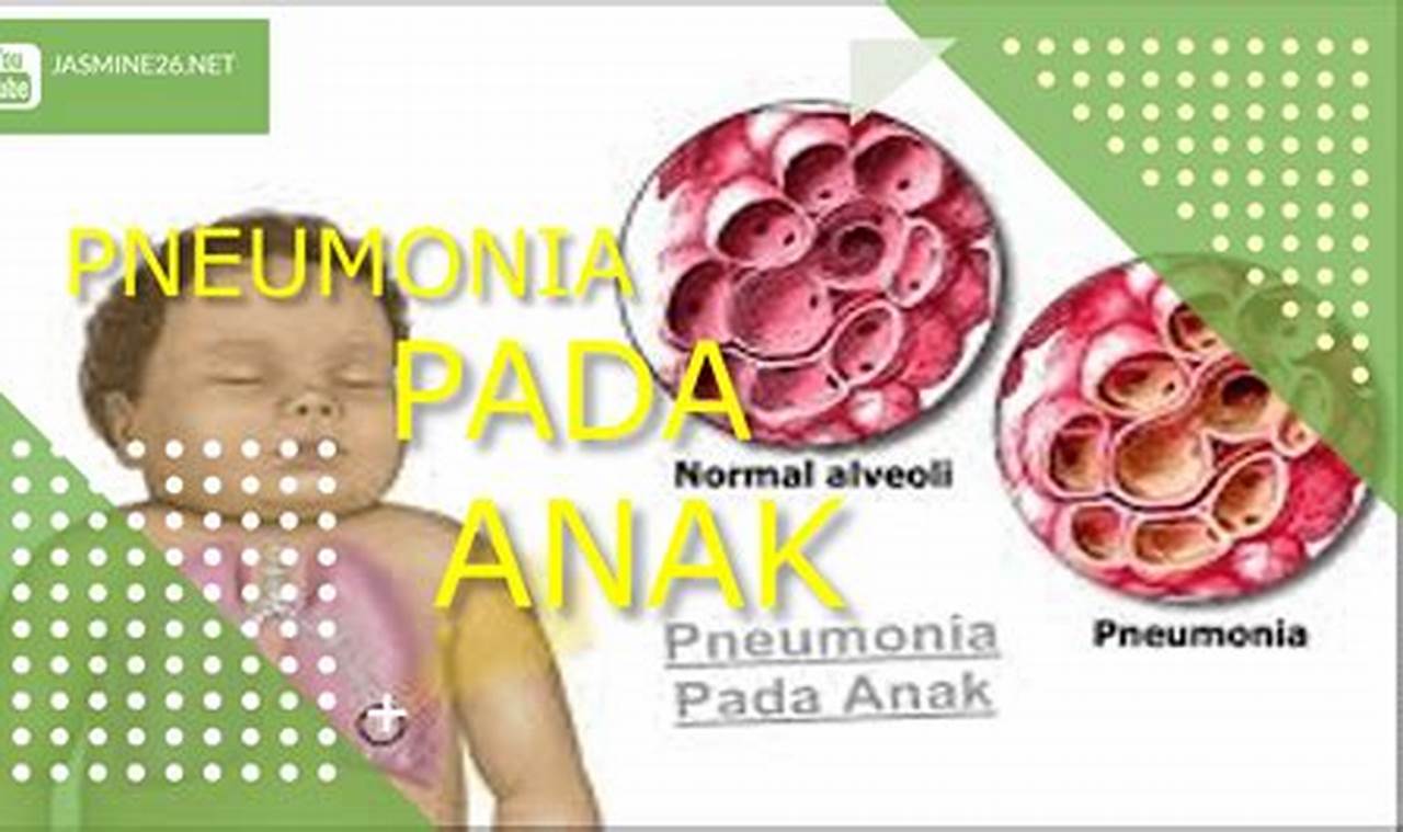 Cara Mengatasi Pneumonia